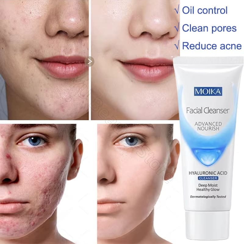 Facial Foam Cleanser