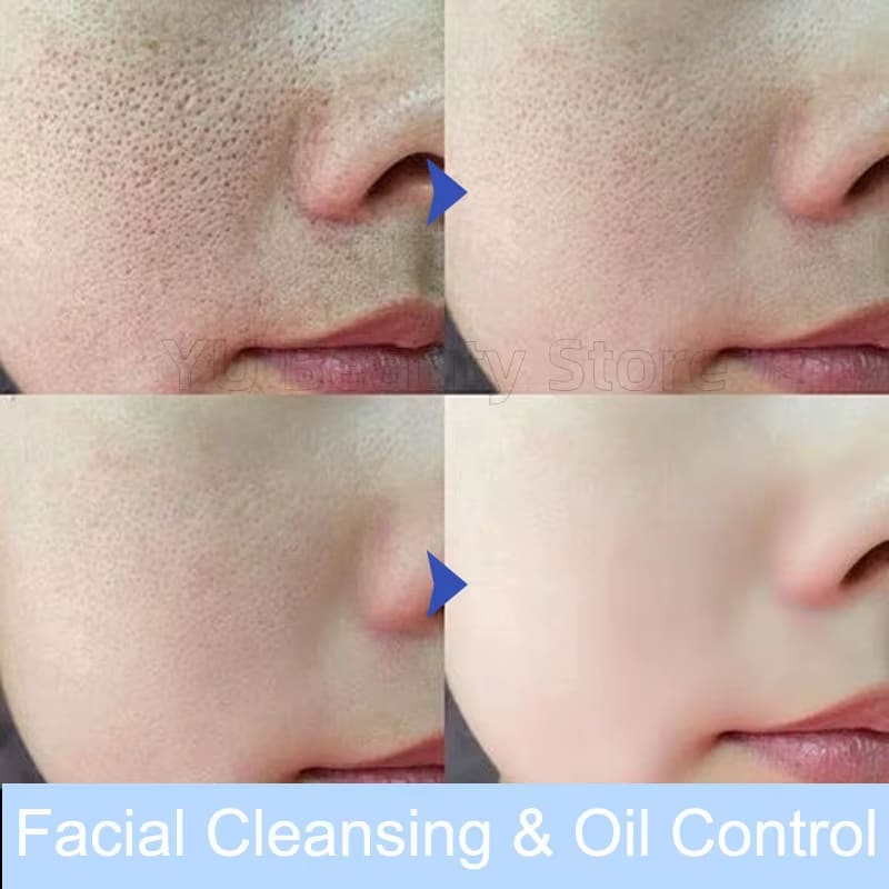 Facial Foam Cleanser